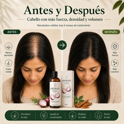 Recupera tu cabello y engrosa la fibra desde la raíz con Excalvo Shampoo USA