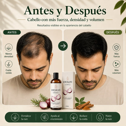 Recupera tu cabello y engrosa la fibra desde la raíz con Excalvo Shampoo USA